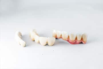 Dental Crowns