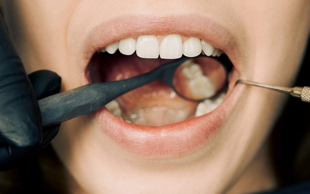 Tooth Enamel: What It’s Made Of, Functions, Lifespan, and Care
